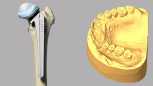 3D Medical Device Scanning